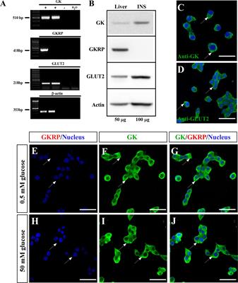 When a Little Bit More Makes the Difference: Expression Levels of GKRP Determines the Subcellular Localization of GK in Tanycytes